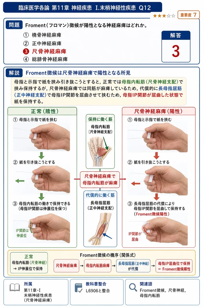 Froment(フロマン)徴候が陽性となる神経麻痺はどれか。 解説図