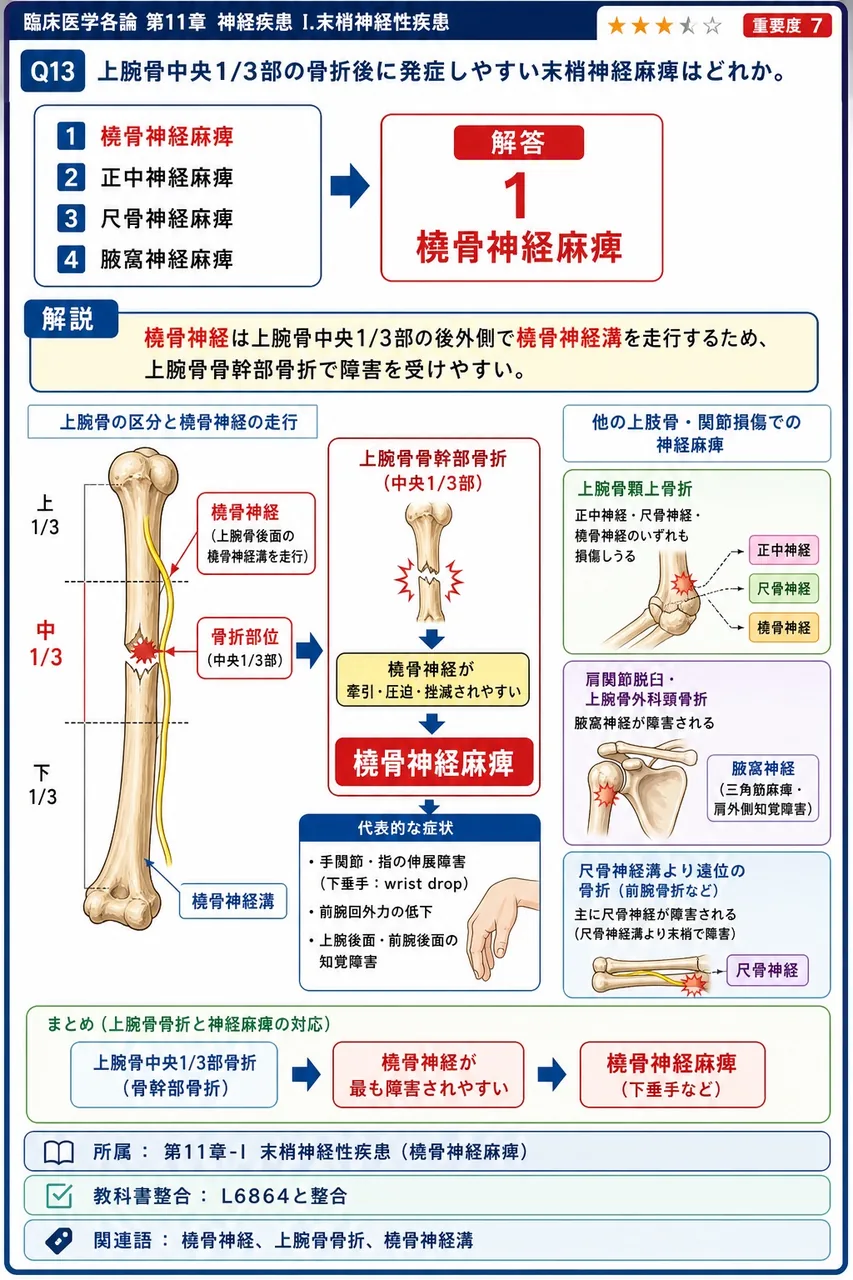 上腕骨中央1/3部の骨折後に発症しやすい末梢神経麻痺はどれか。 解説図