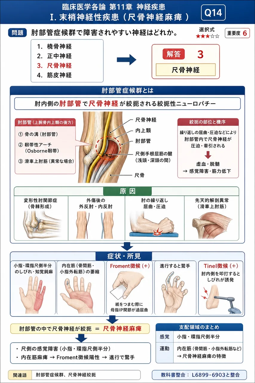 肘部管症候群で障害されやすい神経はどれか。 解説図