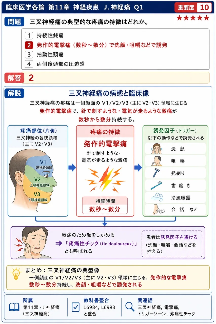 三叉神経痛の典型的な疼痛の特徴はどれか。 解説図
