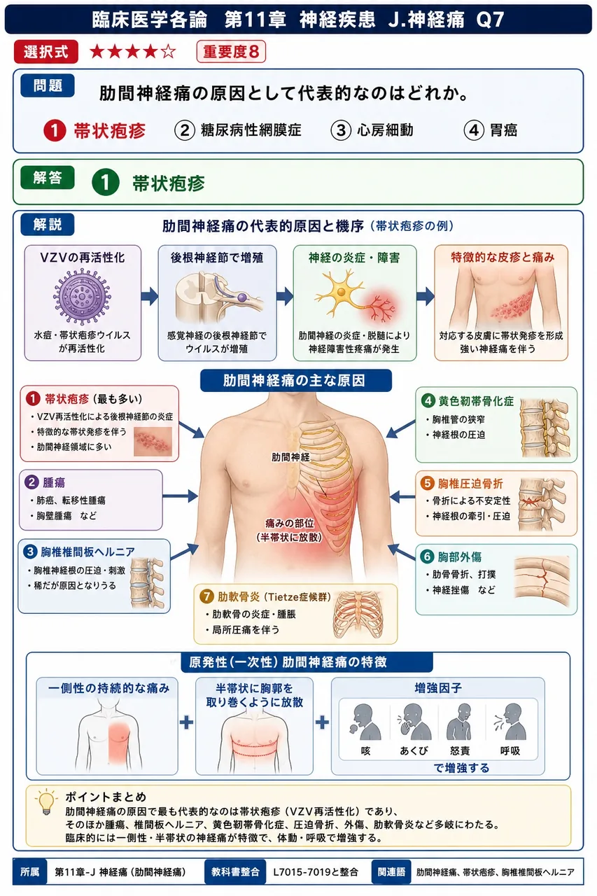 肋間神経痛の原因として代表的なのはどれか。 解説図