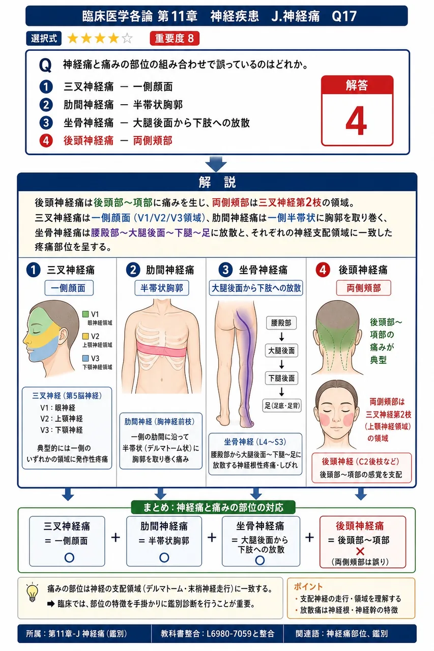 神経痛と痛みの部位の組み合わせで誤っているのはどれか。 解説図