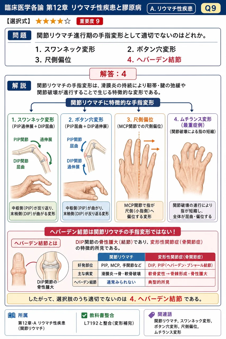 関節リウマチ進行期の手指変形として適切でないのはどれか。 解説図