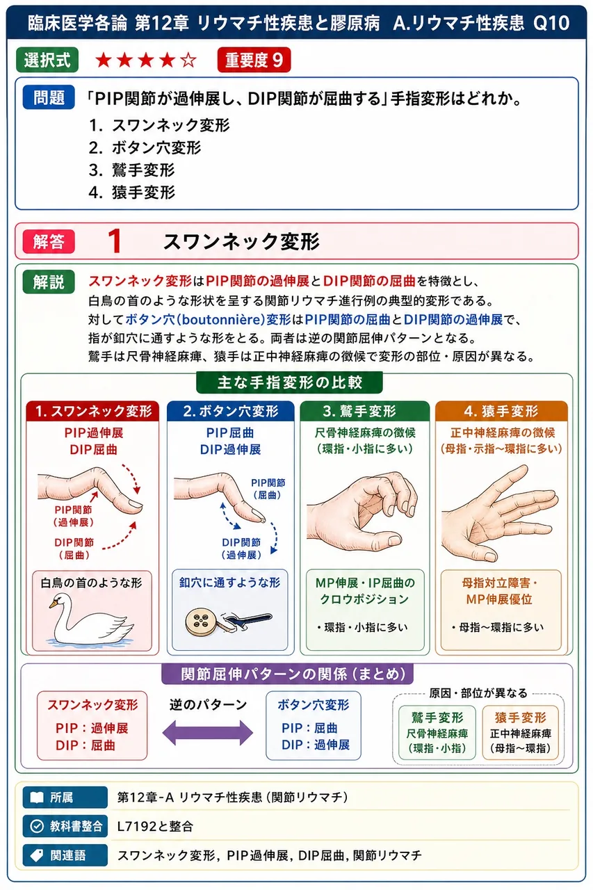 「PIP関節が過伸展し、DIP関節が屈曲する」手指変形はどれか。 解説図