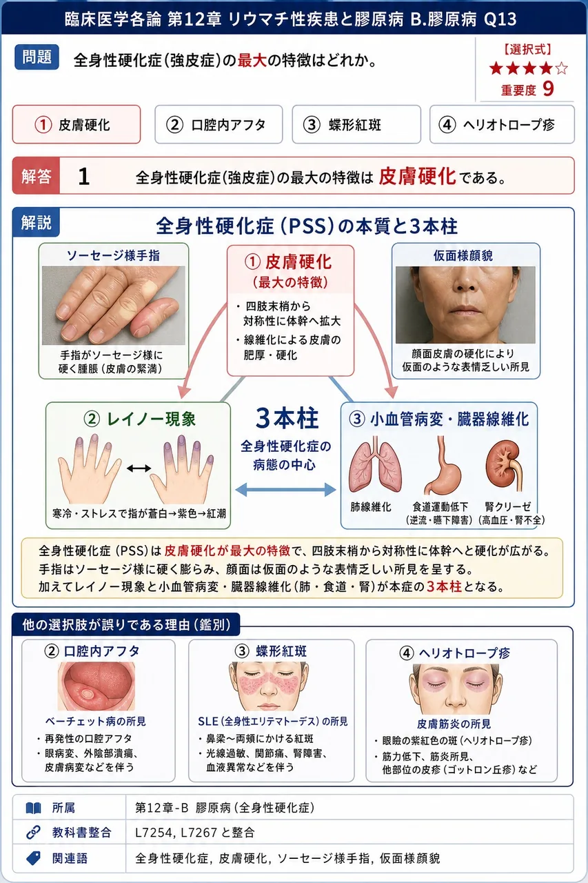 全身性硬化症(強皮症)の最大の特徴はどれか。 解説図