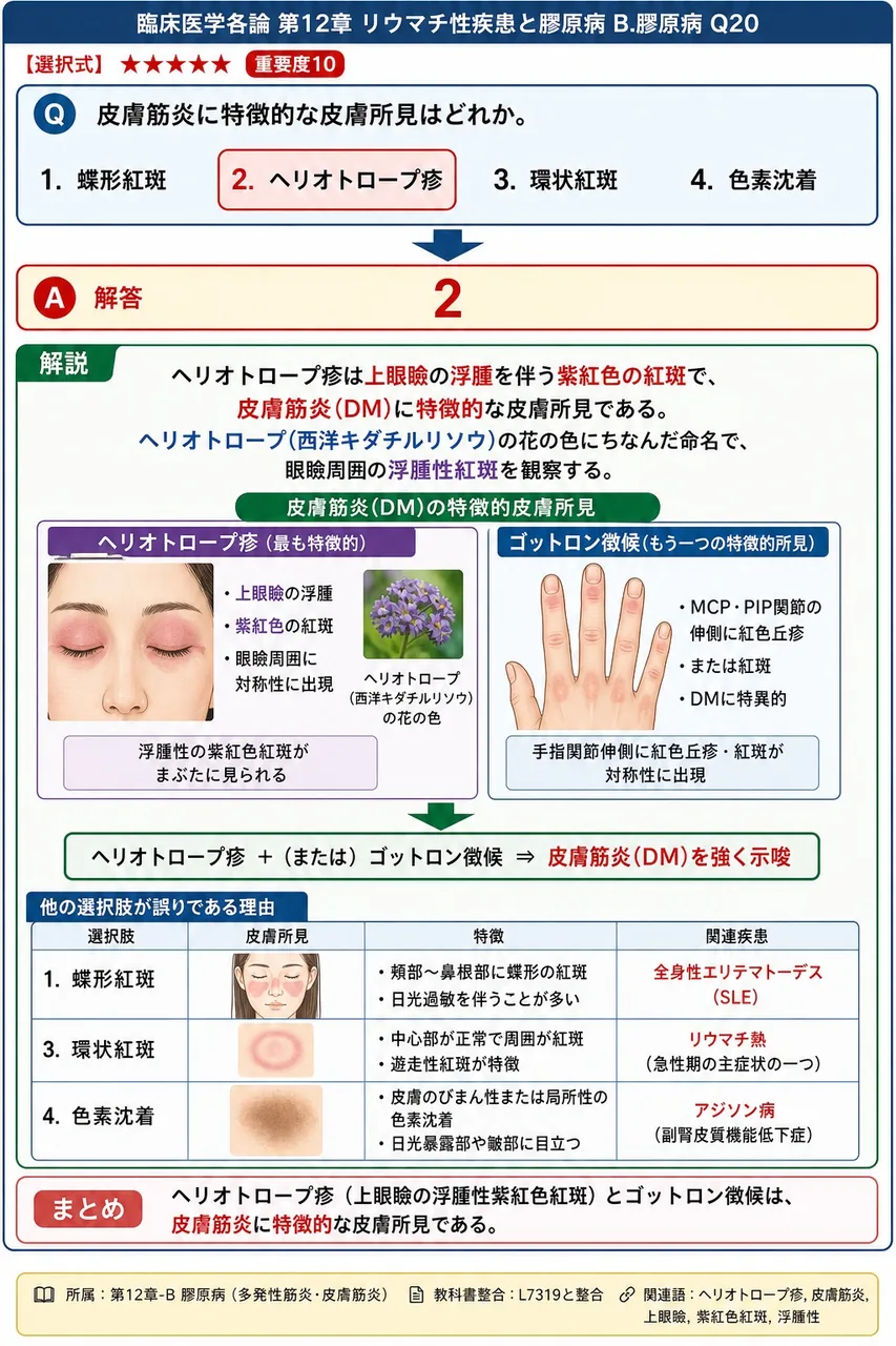 皮膚筋炎に特徴的な皮膚所見はどれか。 解説図