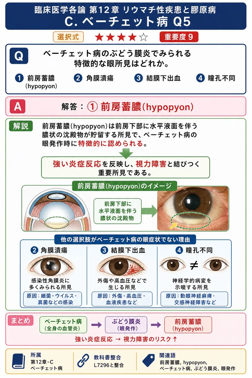 ベーチェット病のぶどう膜炎でみられる特徴的な眼所見はどれか。 解説図