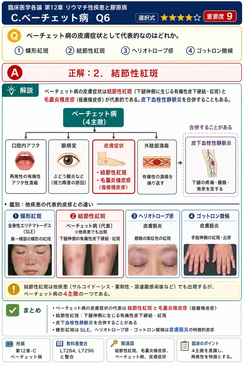 ベーチェット病の皮膚症状として代表的なのはどれか。 解説図