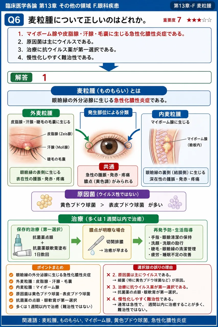 麦粒腫について正しいのはどれか。 解説図