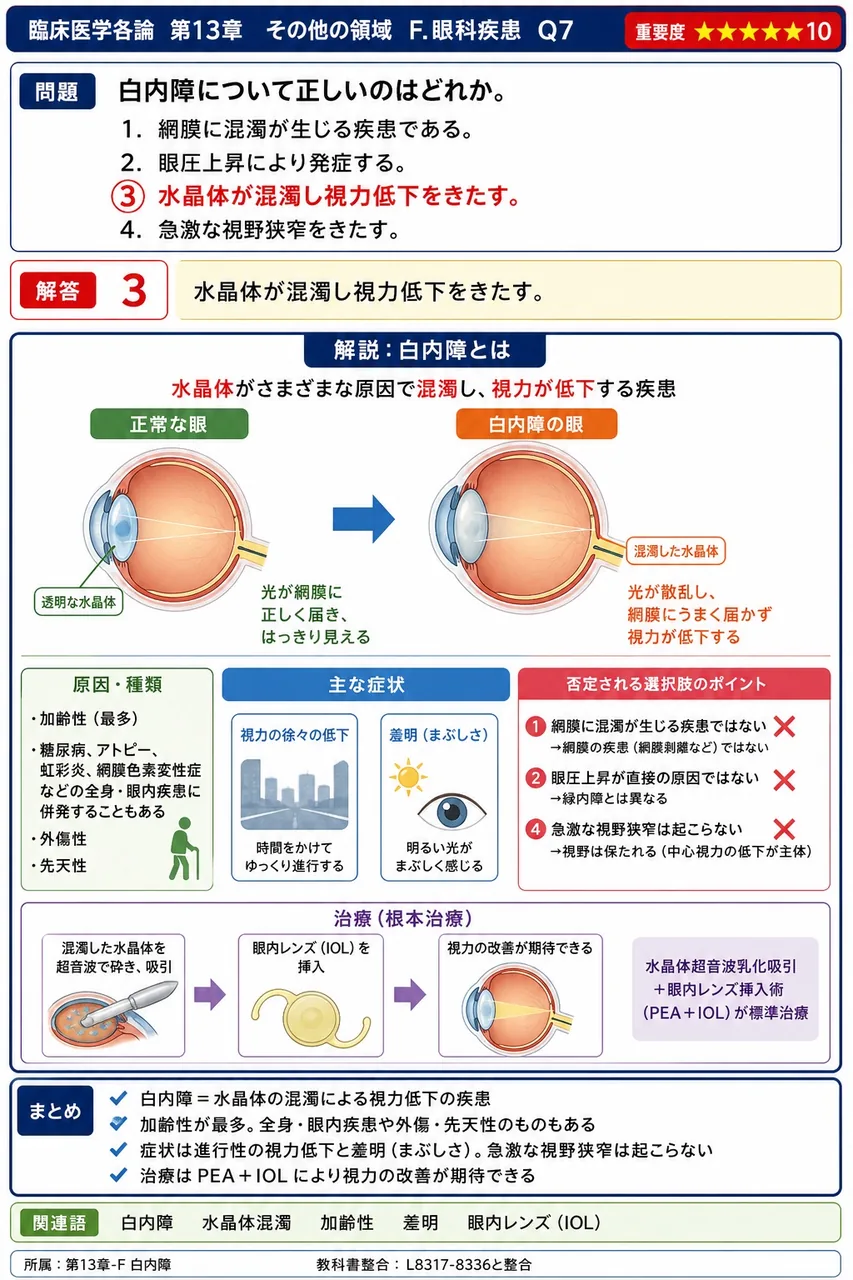 白内障について正しいのはどれか。 解説図