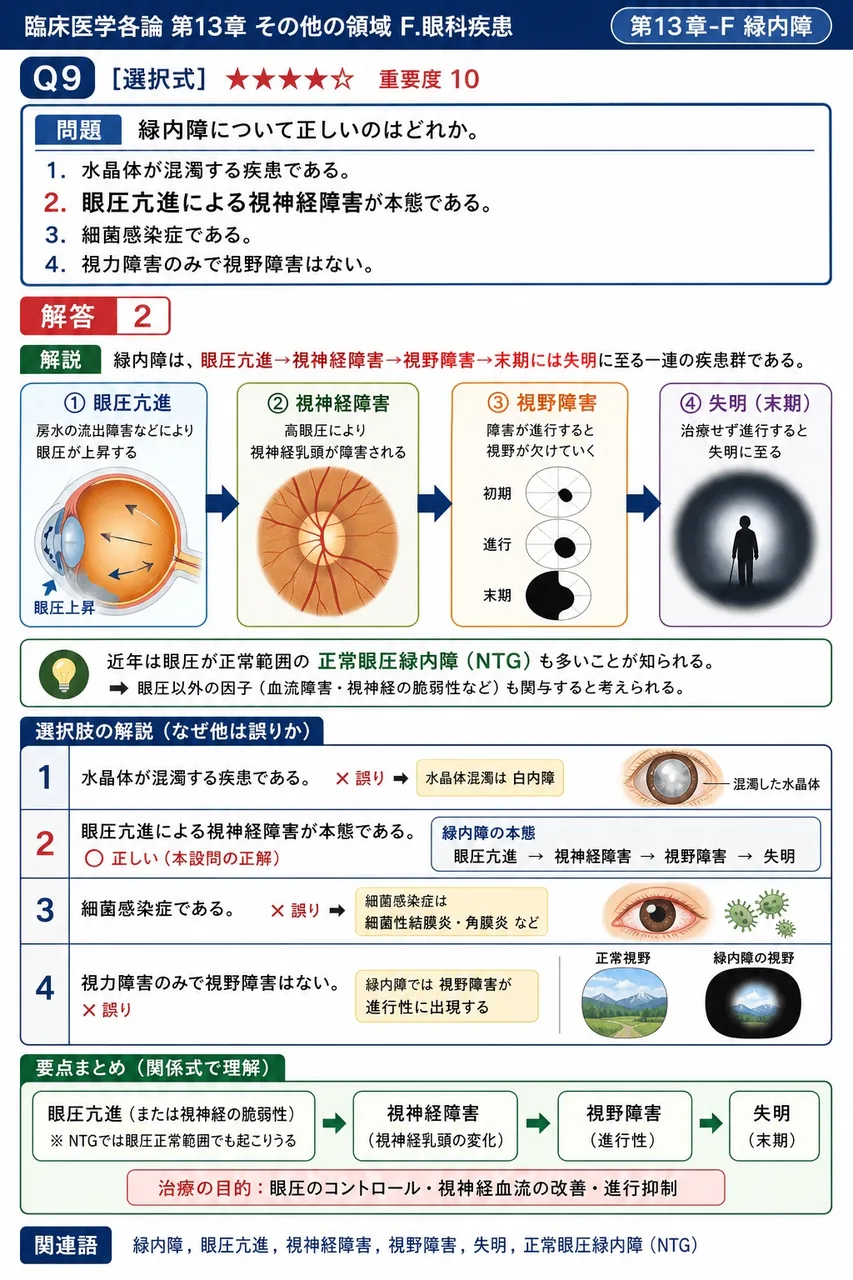 緑内障について正しいのはどれか。 解説図