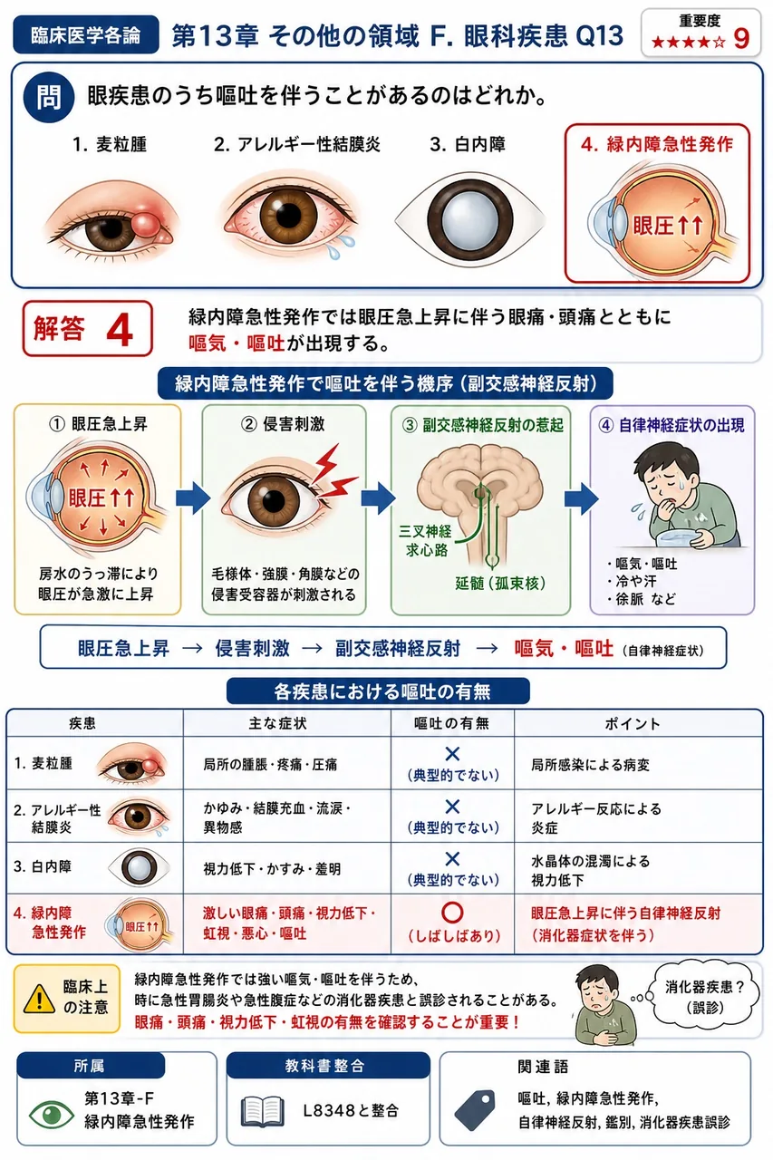眼疾患のうち嘔吐を伴うことがあるのはどれか。 解説図