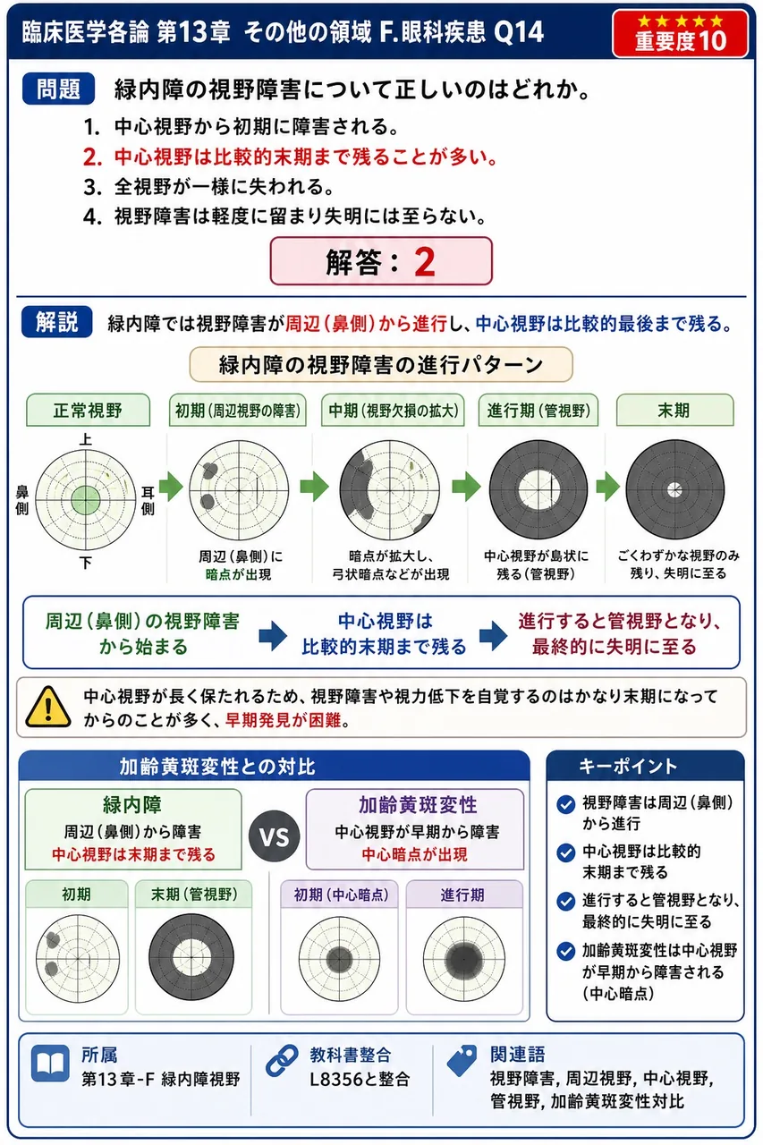 緑内障の視野障害について正しいのはどれか。 解説図