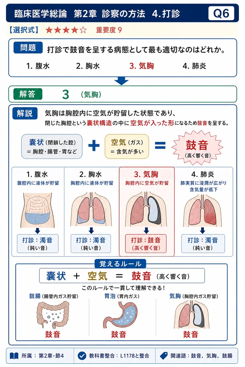 打診で鼓音を呈する病態として最も適切なのはどれか。 解説図