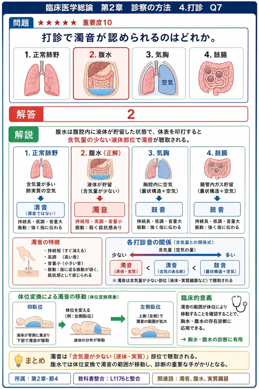 打診で濁音が認められるのはどれか。 解説図