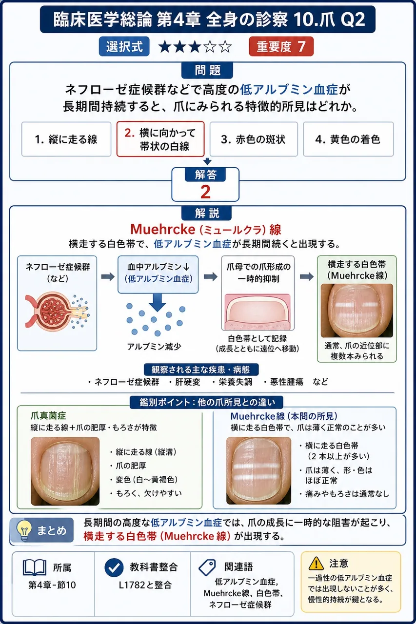 ネフローゼ症候群などで**高度の低アルブミン血症**が長期間持続すると、爪にみられる特徴的所見はどれか。 解説図