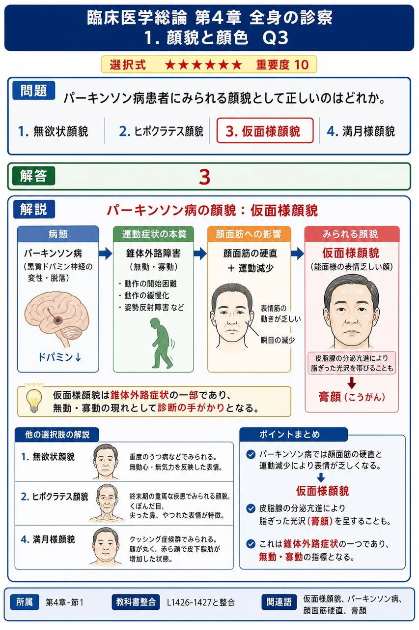 パーキンソン病患者にみられる顔貌として正しいのはどれか。 解説図