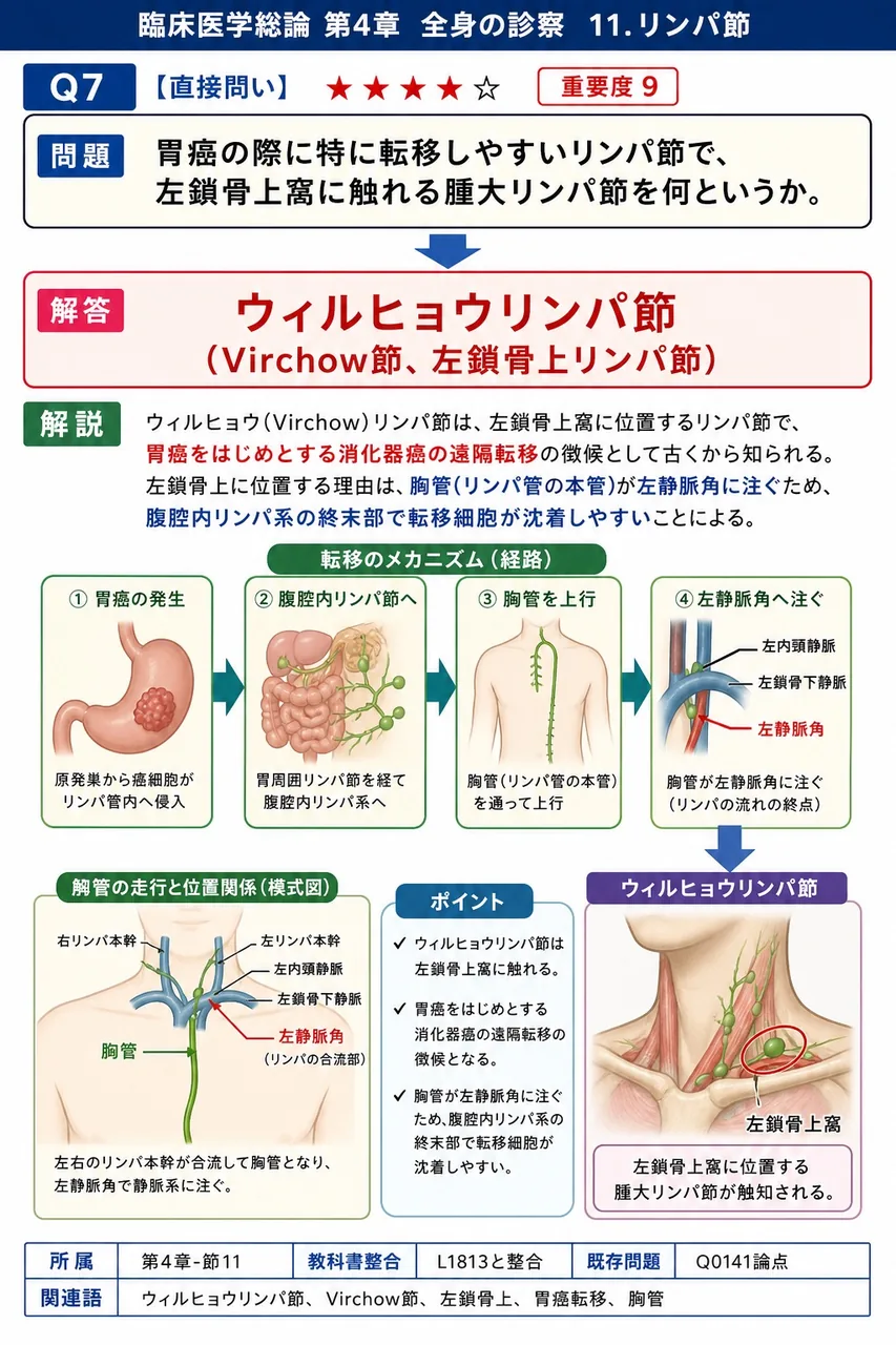 胃癌の際に特に転移しやすいリンパ節で、左鎖骨上窩に触れる腫大リンパ節を何というか。 解説図