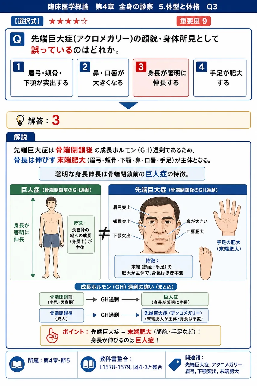 先端巨大症(アクロメガリー)の顔貌・身体所見として誤っているのはどれか。 解説図