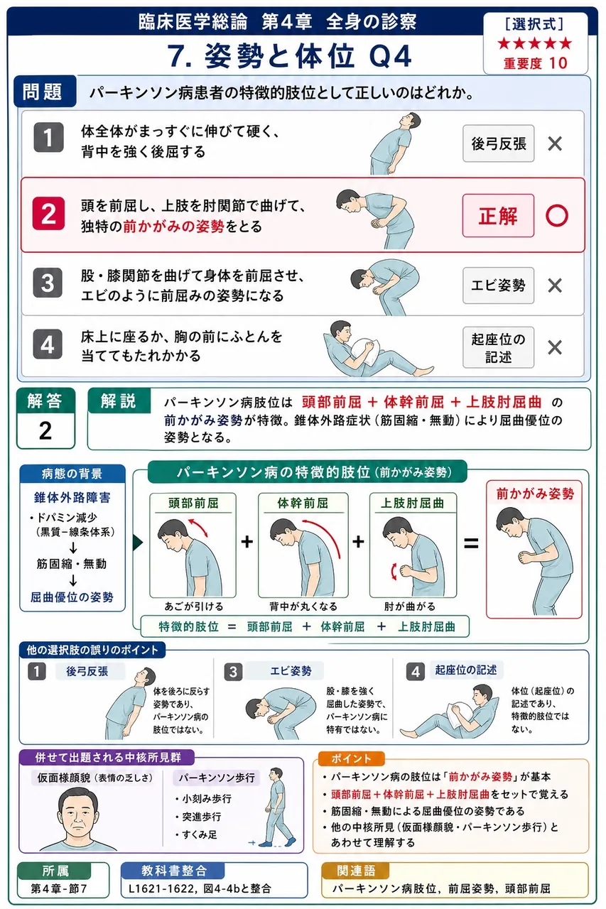 パーキンソン病患者の特徴的肢位として正しいのはどれか。 解説図