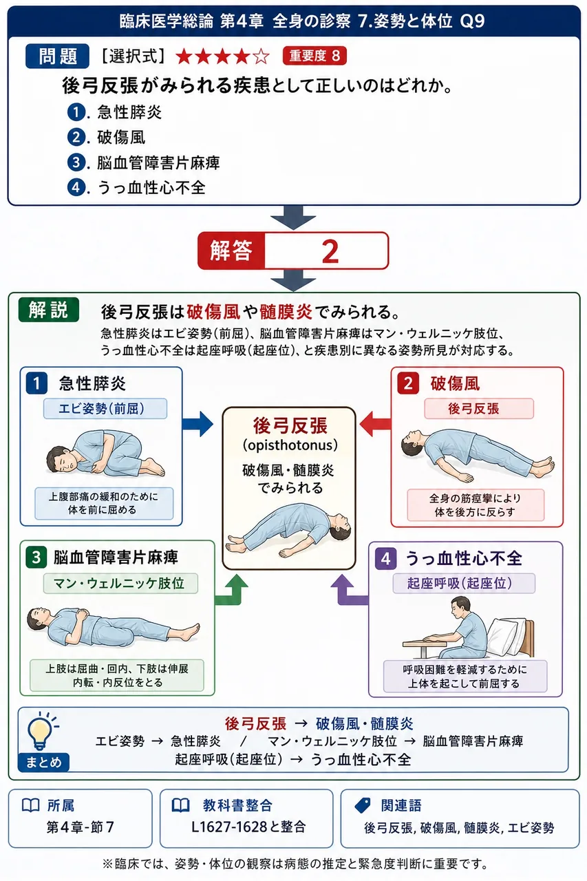 後弓反張がみられる疾患として正しいのはどれか。 解説図