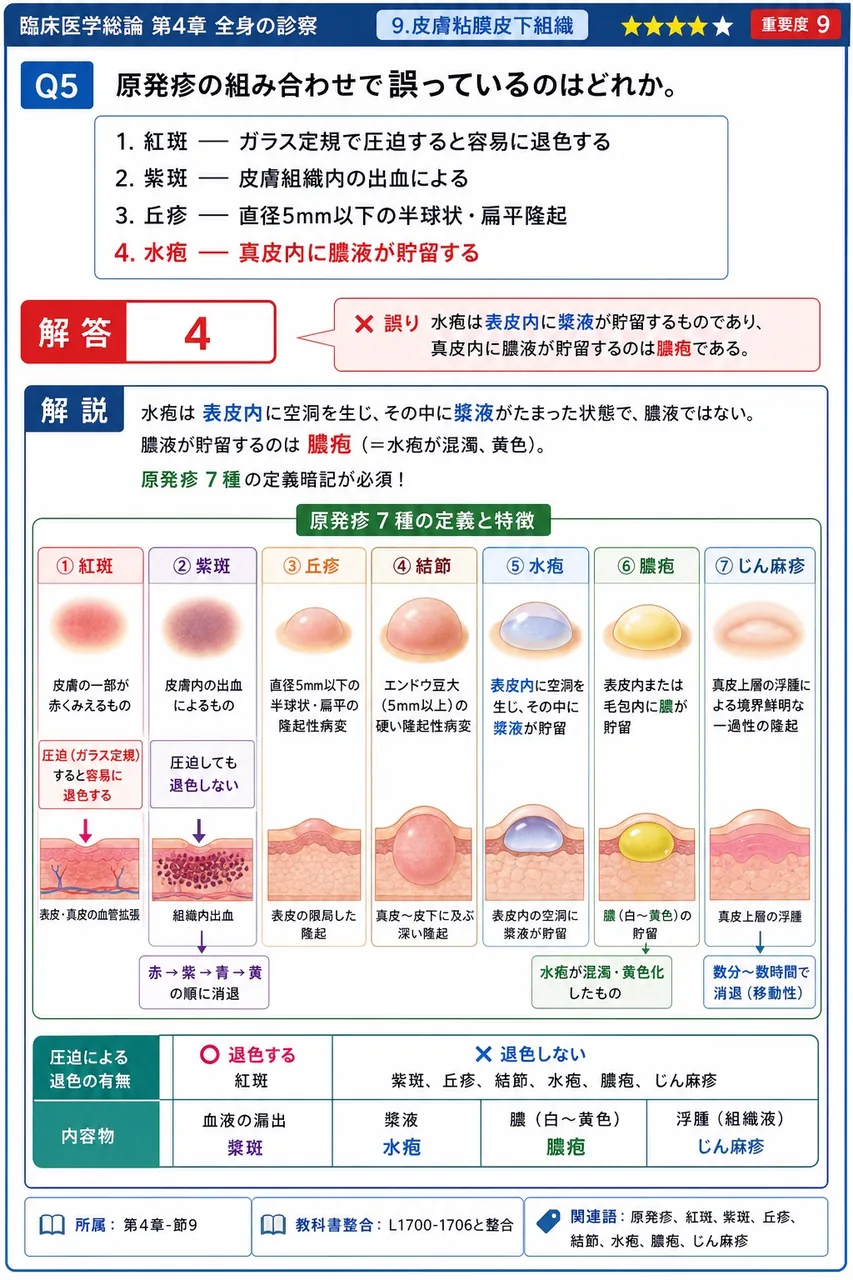 原発疹の組み合わせで誤っているのはどれか。 解説図