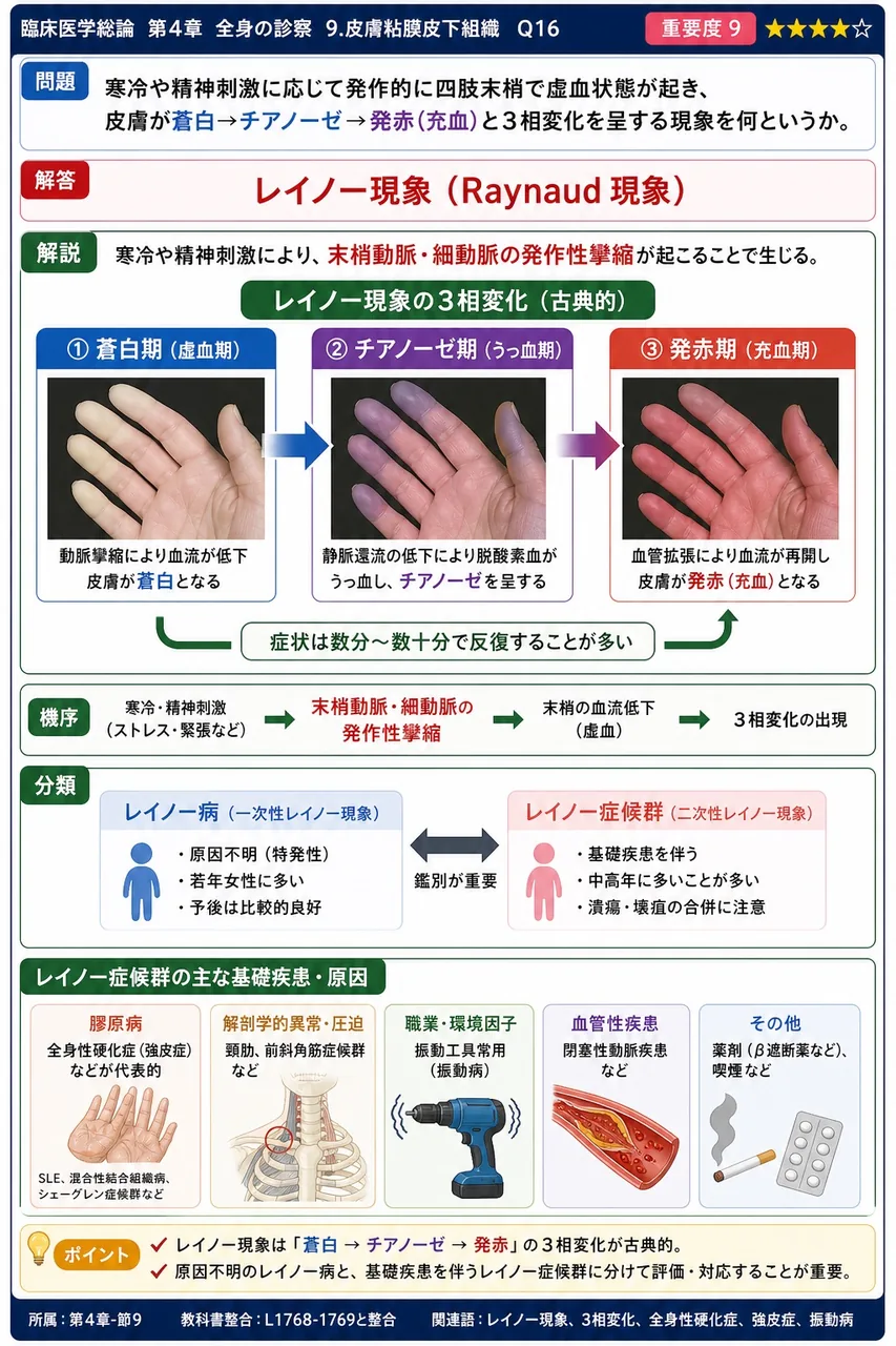 寒冷や精神刺激に応じて発作的に四肢末梢で虚血状態が起き、皮膚が蒼白→チアノーゼ→発赤(充血)と3相変化を呈する現象を何というか。 解説図