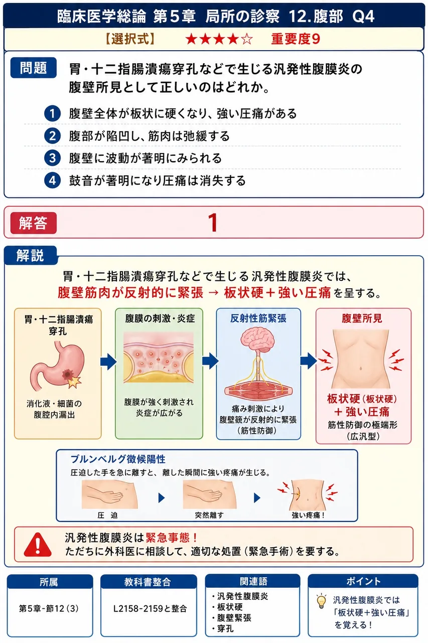 胃・十二指腸潰瘍穿孔などで生じる汎発性腹膜炎の腹壁所見として正しいのはどれか。 解説図