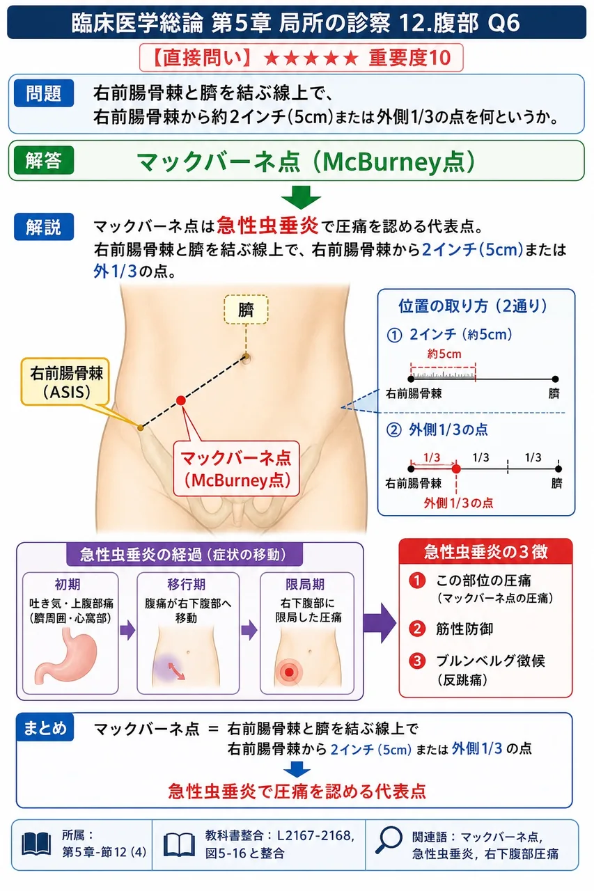 右前腸骨棘と臍を結ぶ線上で、右前腸骨棘から約2インチ(5cm)または外側1/3の点を何というか。 解説図