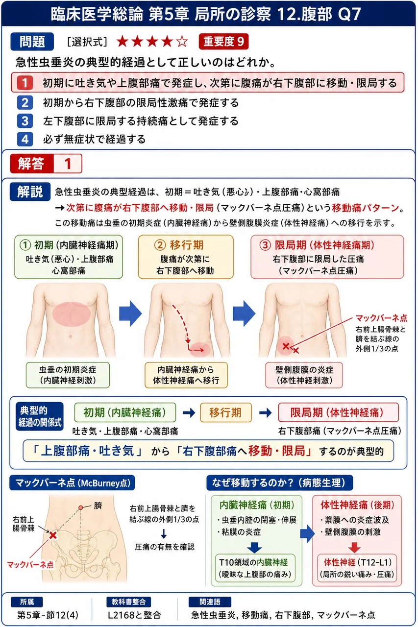 急性虫垂炎の典型的経過として正しいのはどれか。 解説図