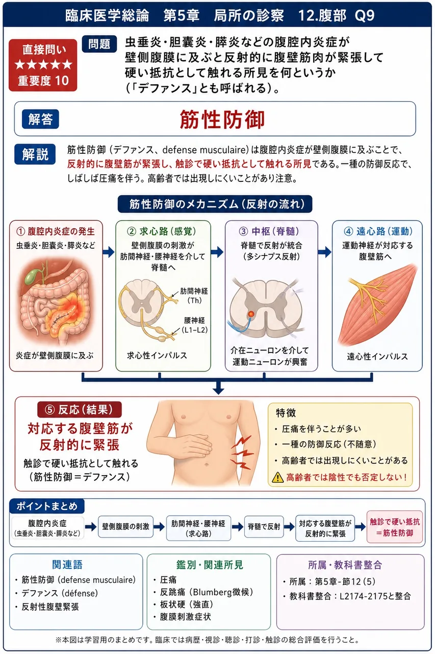 虫垂炎・胆囊炎・膵炎などの腹腔内炎症が壁側腹膜に及ぶと反射的に腹壁筋肉が緊張して硬い抵抗として触れる所見を何というか(「デファンス」とも呼ばれる)。 解説図