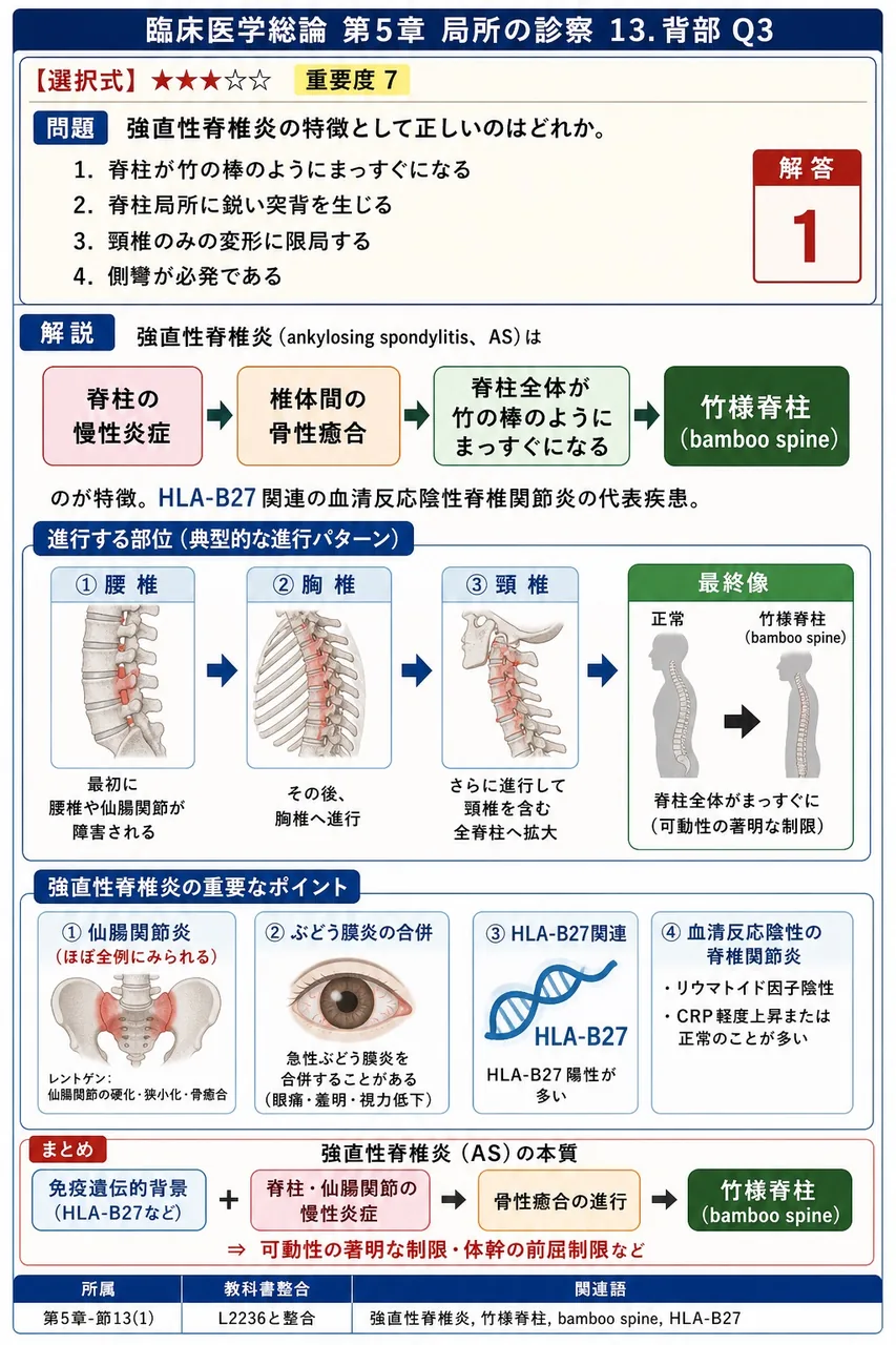 強直性脊椎炎の特徴として正しいのはどれか。 解説図
