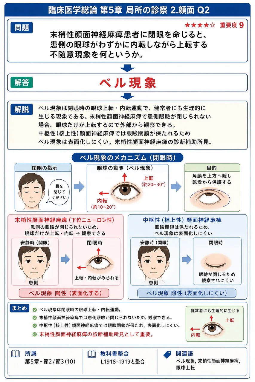 末梢性顔面神経麻痺患者に閉眼を命じると、患側の眼球がわずかに内転しながら上転する不随意現象を何というか。 解説図