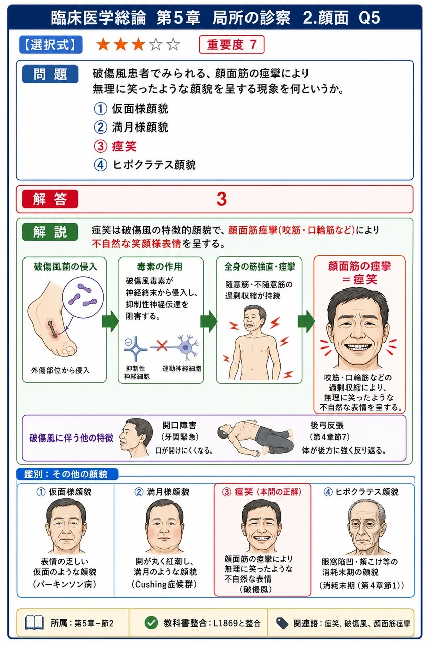 破傷風患者でみられる、顔面筋の痙攣により無理に笑ったような顔貌を呈する現象を何というか。 解説図