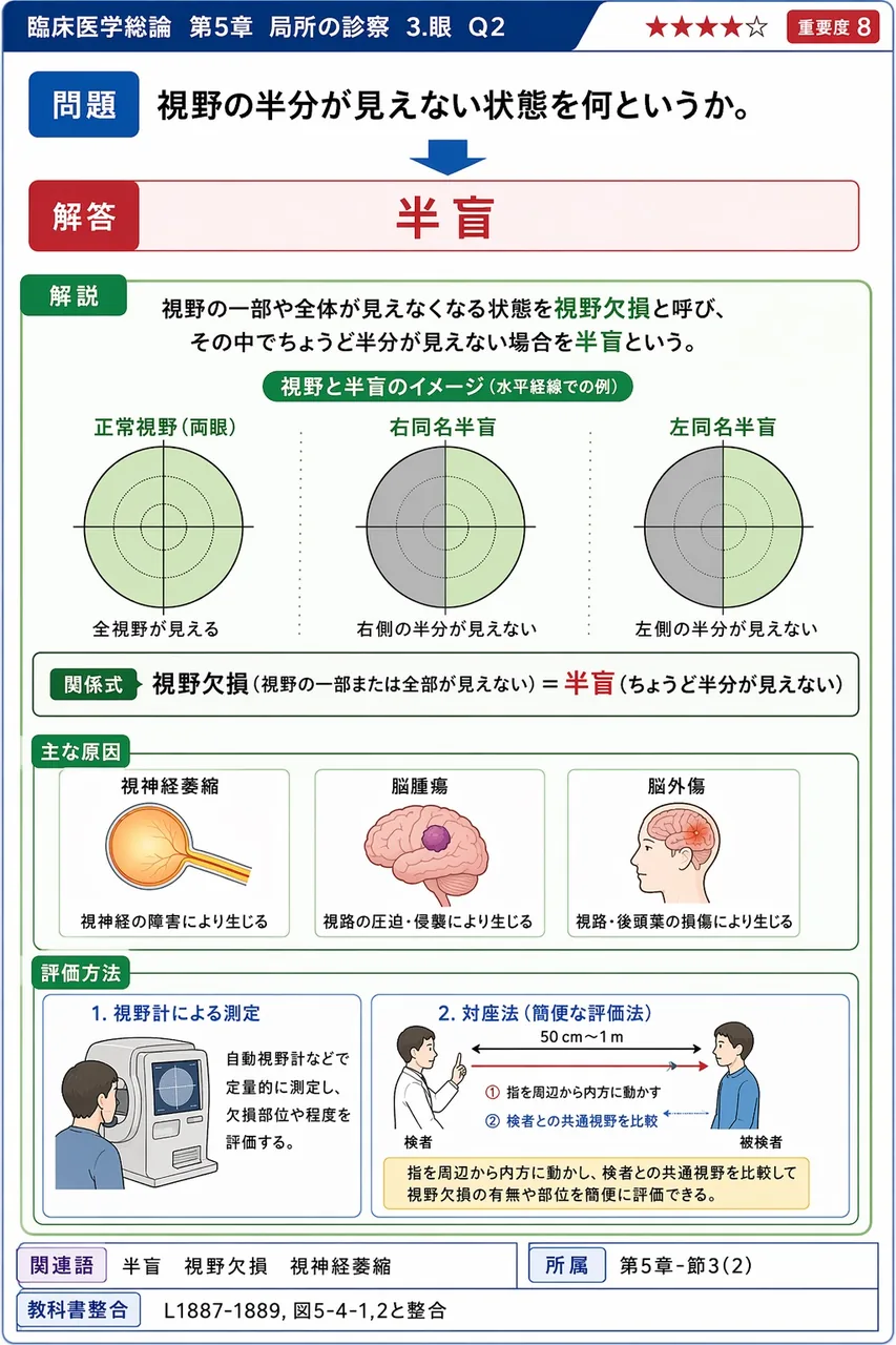 視野の半分が見えない状態を何というか。 解説図