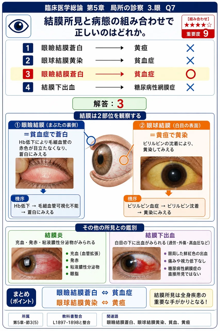 結膜所見と病態の組み合わせで正しいのはどれか。 解説図