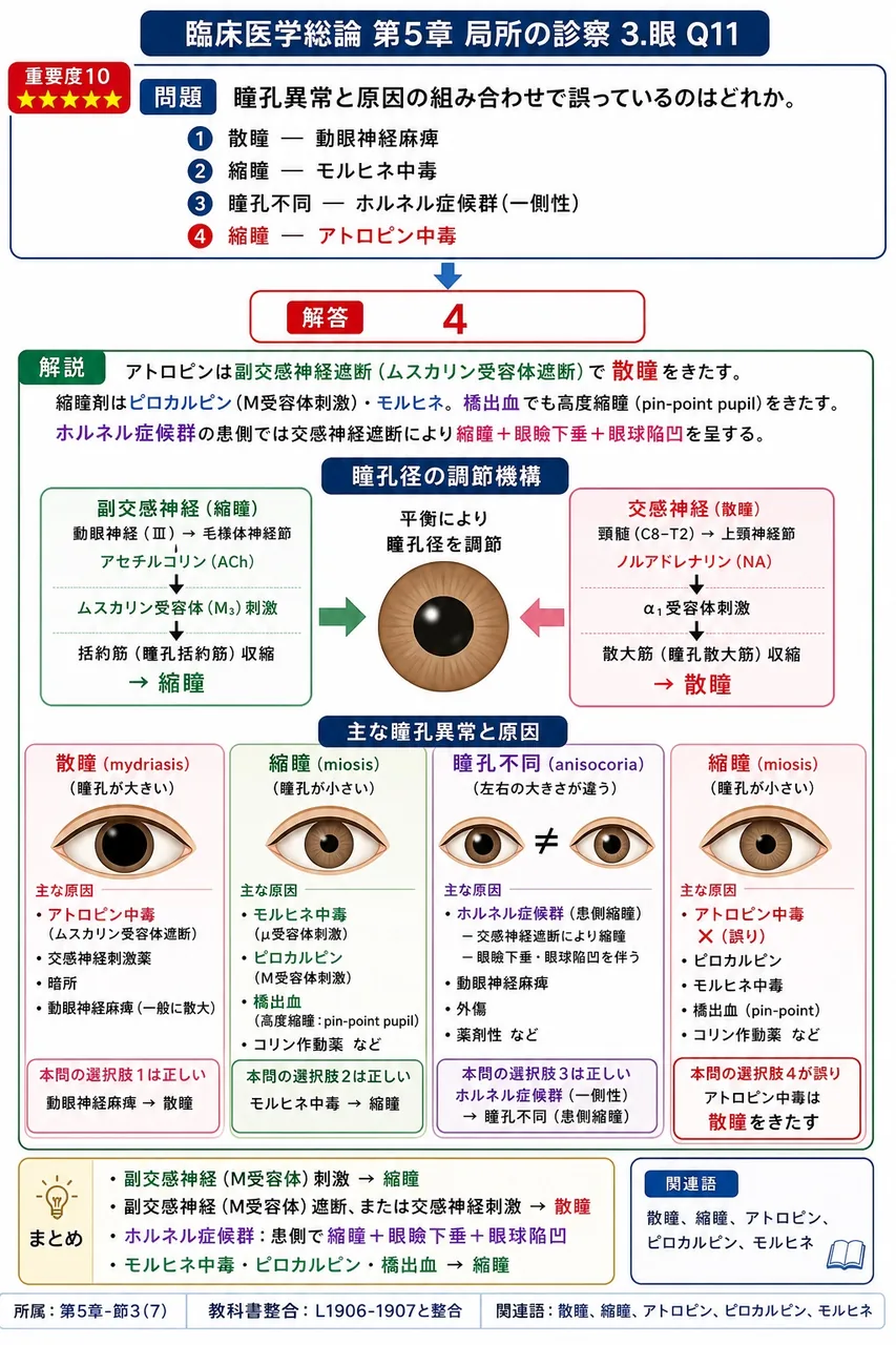 瞳孔異常と原因の組み合わせで誤っているのはどれか。 解説図