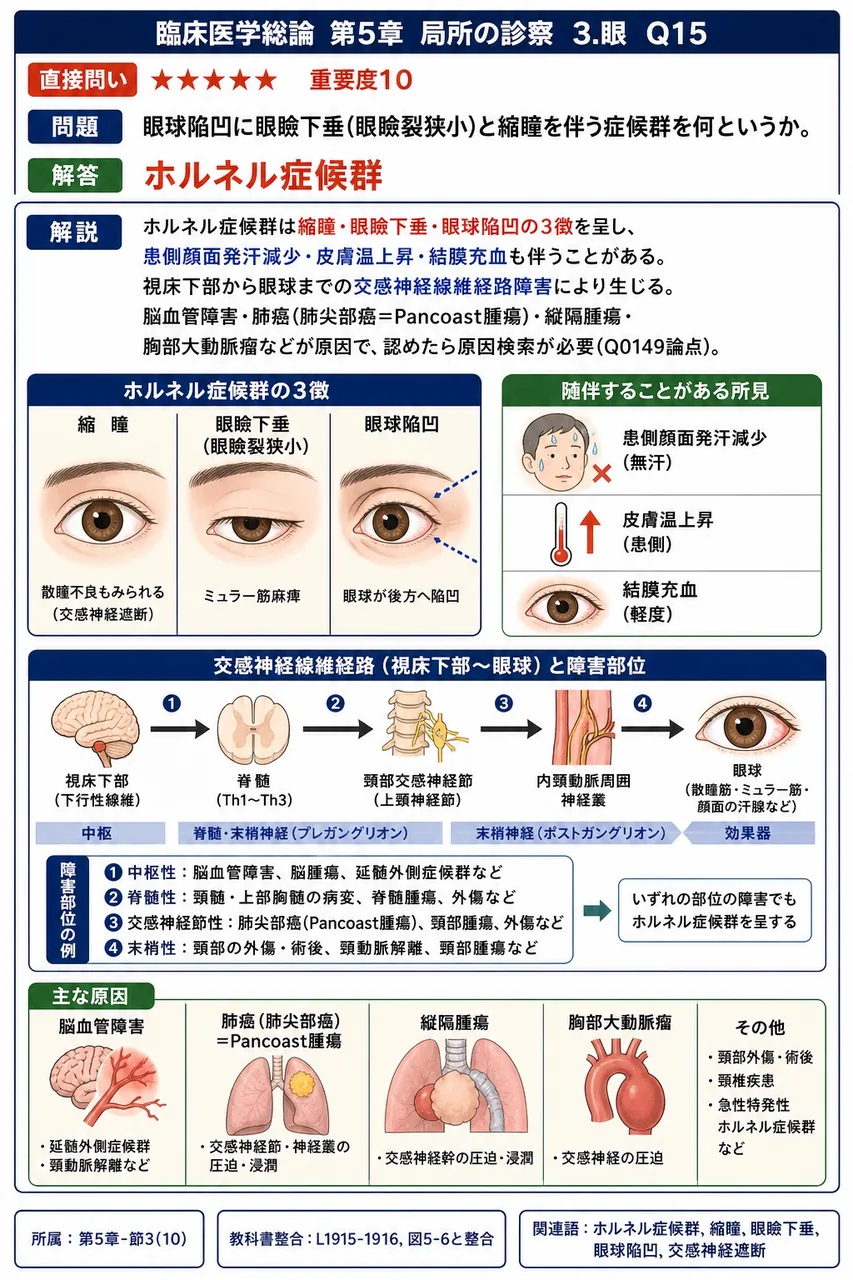 眼球陥凹に眼瞼下垂(眼瞼裂狭小)と縮瞳を伴う症候群を何というか。 解説図