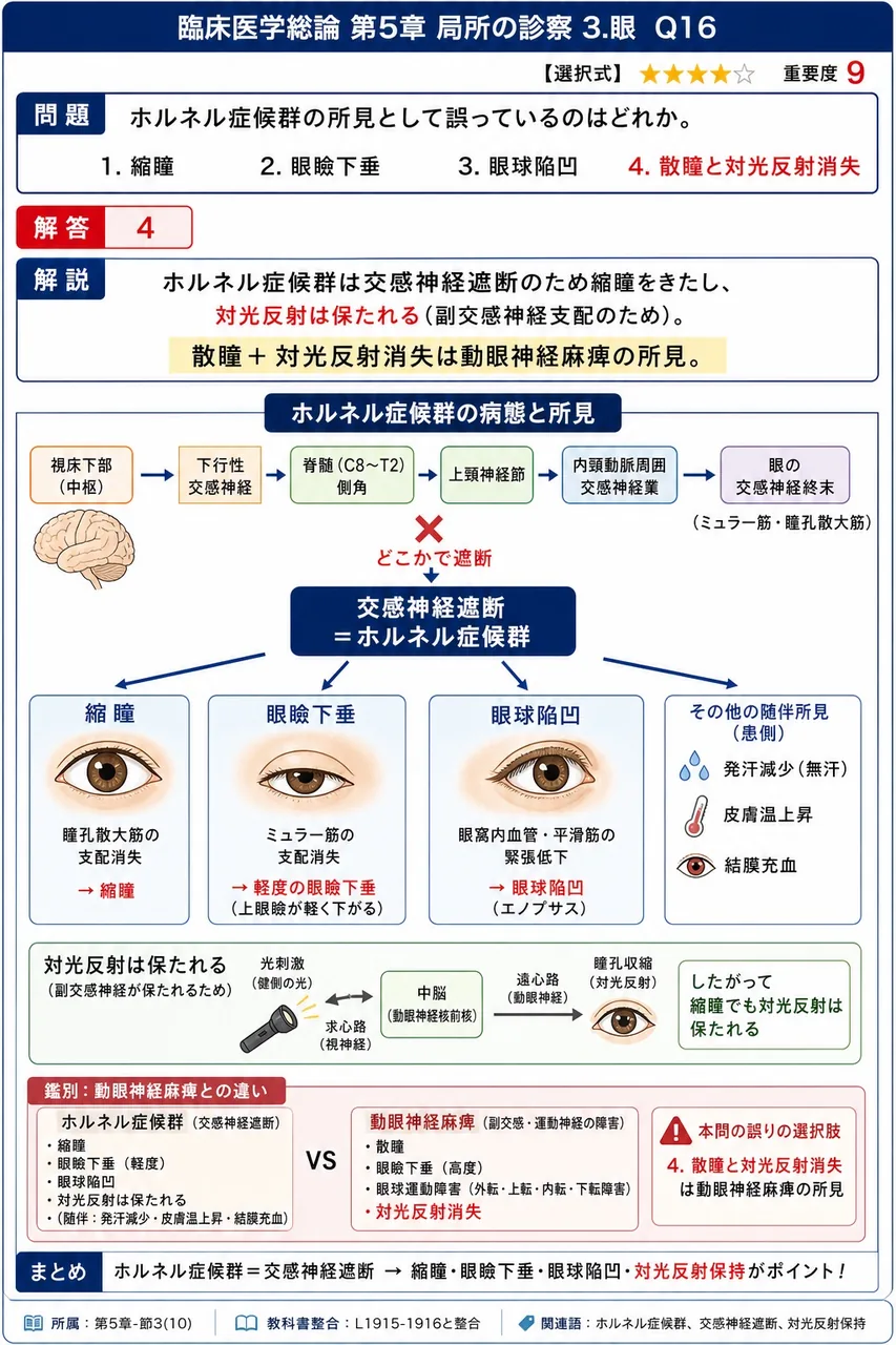 ホルネル症候群の所見として誤っているのはどれか。 解説図
