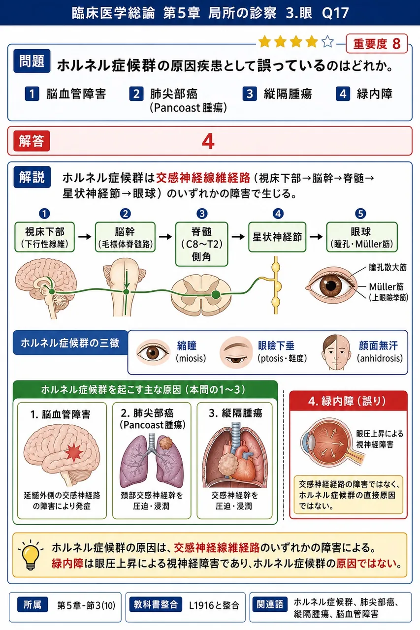 ホルネル症候群の原因疾患として誤っているのはどれか。 解説図