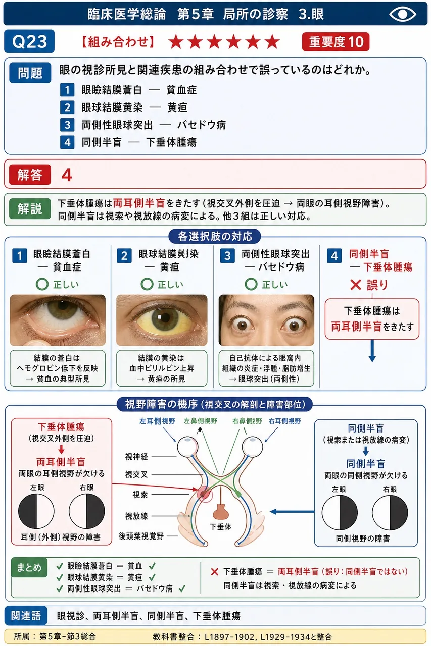 眼の視診所見と関連疾患の組み合わせで誤っているのはどれか。 解説図