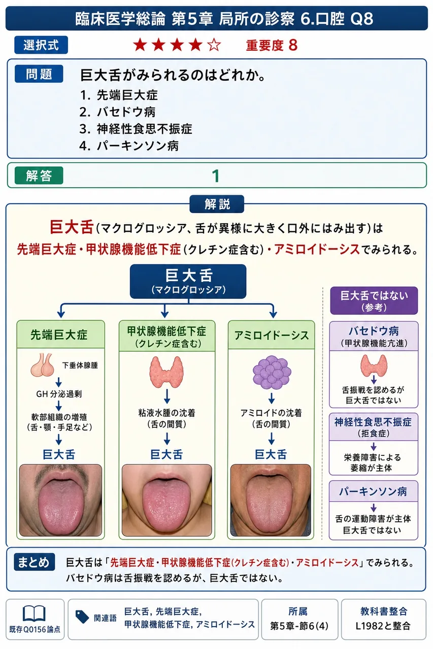 巨大舌がみられるのはどれか。 解説図