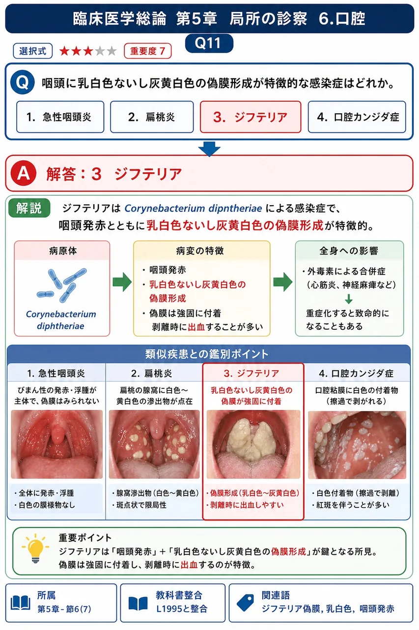 咽頭に乳白色ないし灰黄白色の偽膜形成が特徴的な感染症はどれか。 解説図