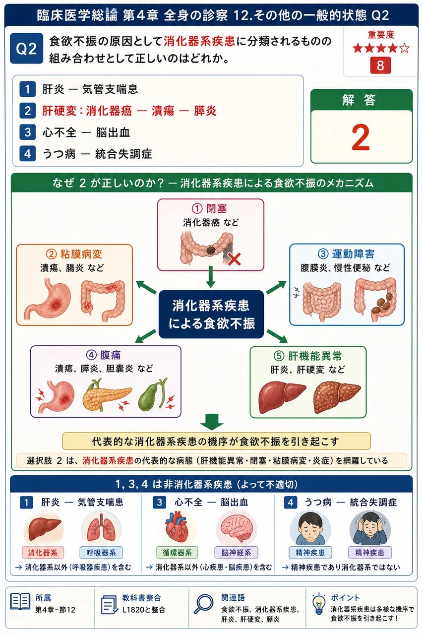 迷走神経の一側麻痺により軟口蓋が片側のみ挙上せず、口蓋垂が健側へ傾く徴候を何というか。 解説図