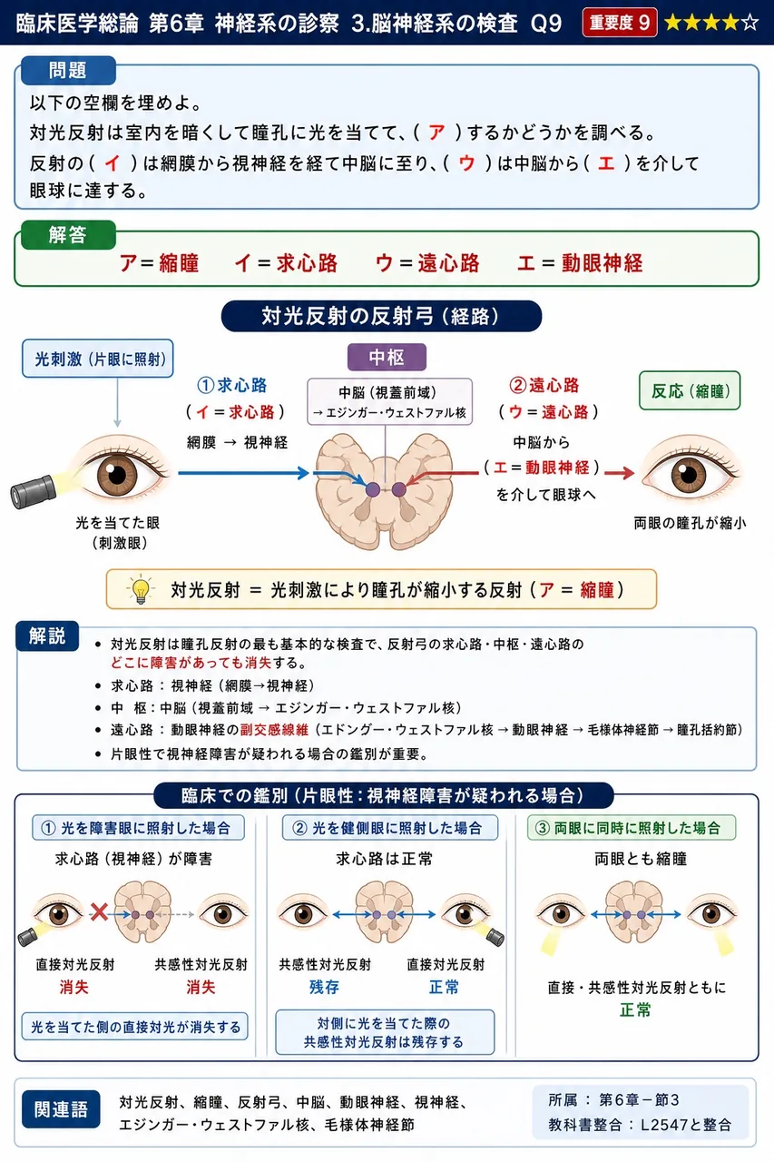 以下の空欄を埋めよ。 対光反射は室内を暗くして瞳孔に光を当てて、( ア )するかどうかを調べる。反射の( イ )は網膜から視神経を経て中脳に至り、( ウ )は中脳から( エ )を介して眼球に達する。 解説図