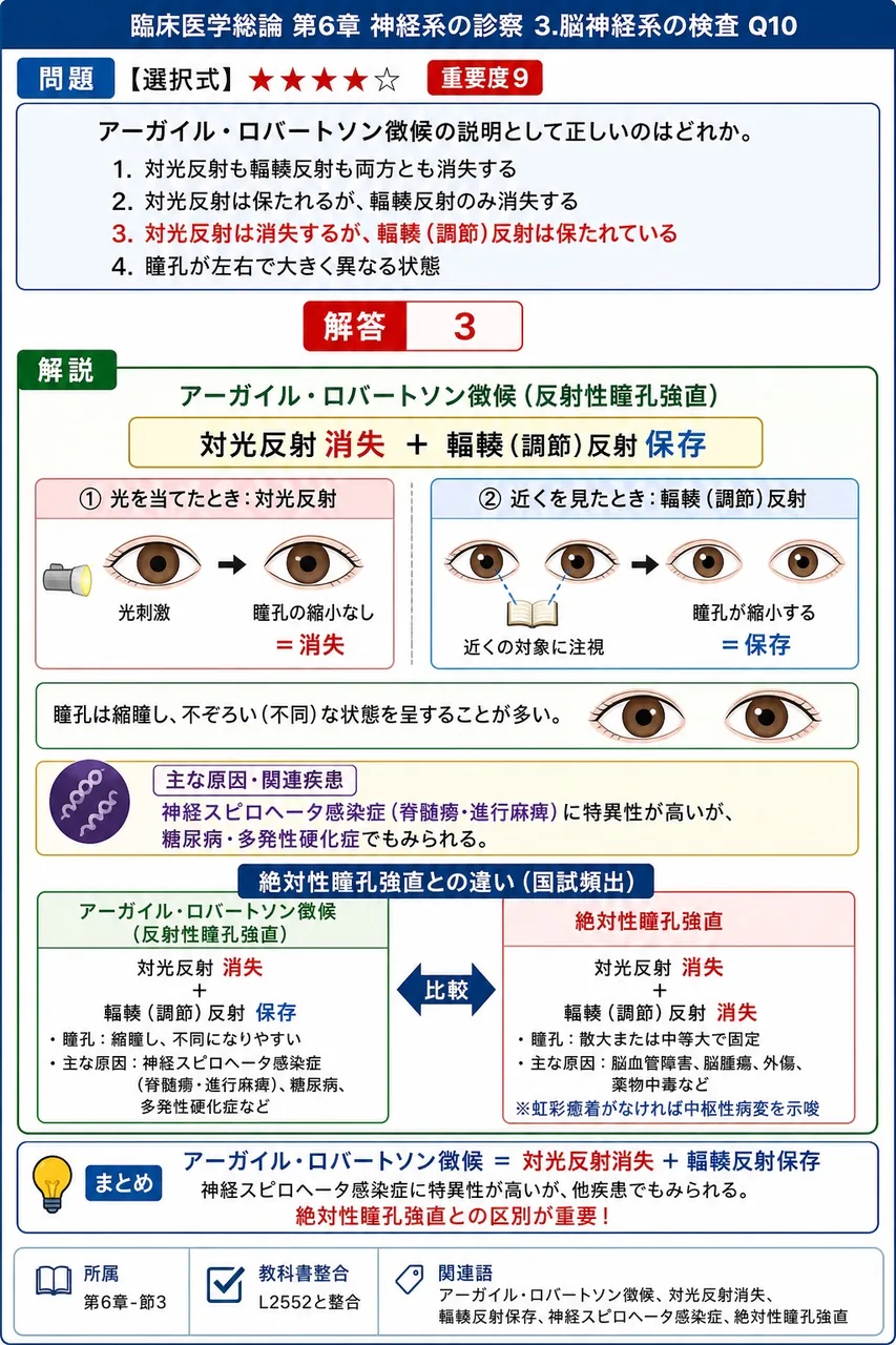 アーガイル・ロバートソン徴候の説明として正しいのはどれか。 解説図