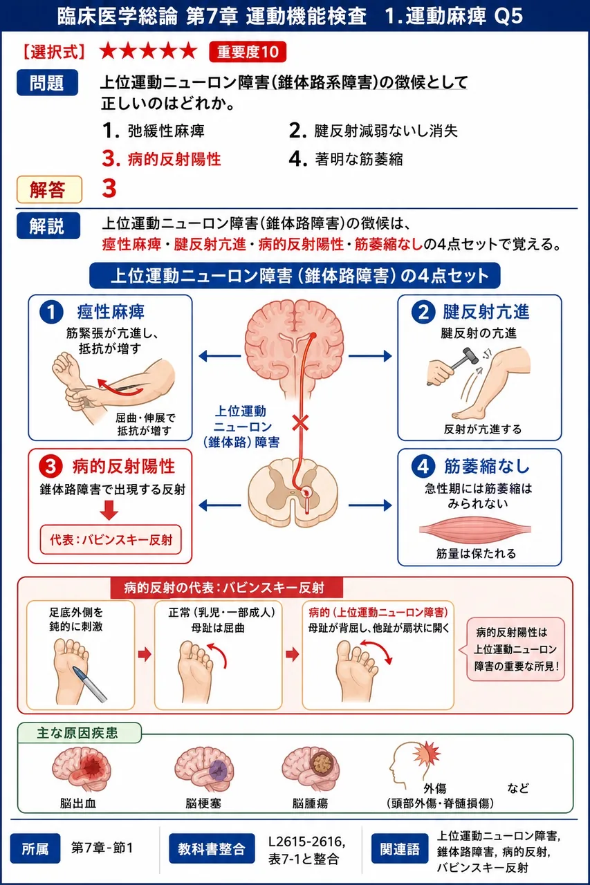上位運動ニューロン障害(錐体路系障害)の徴候として正しいのはどれか。 解説図