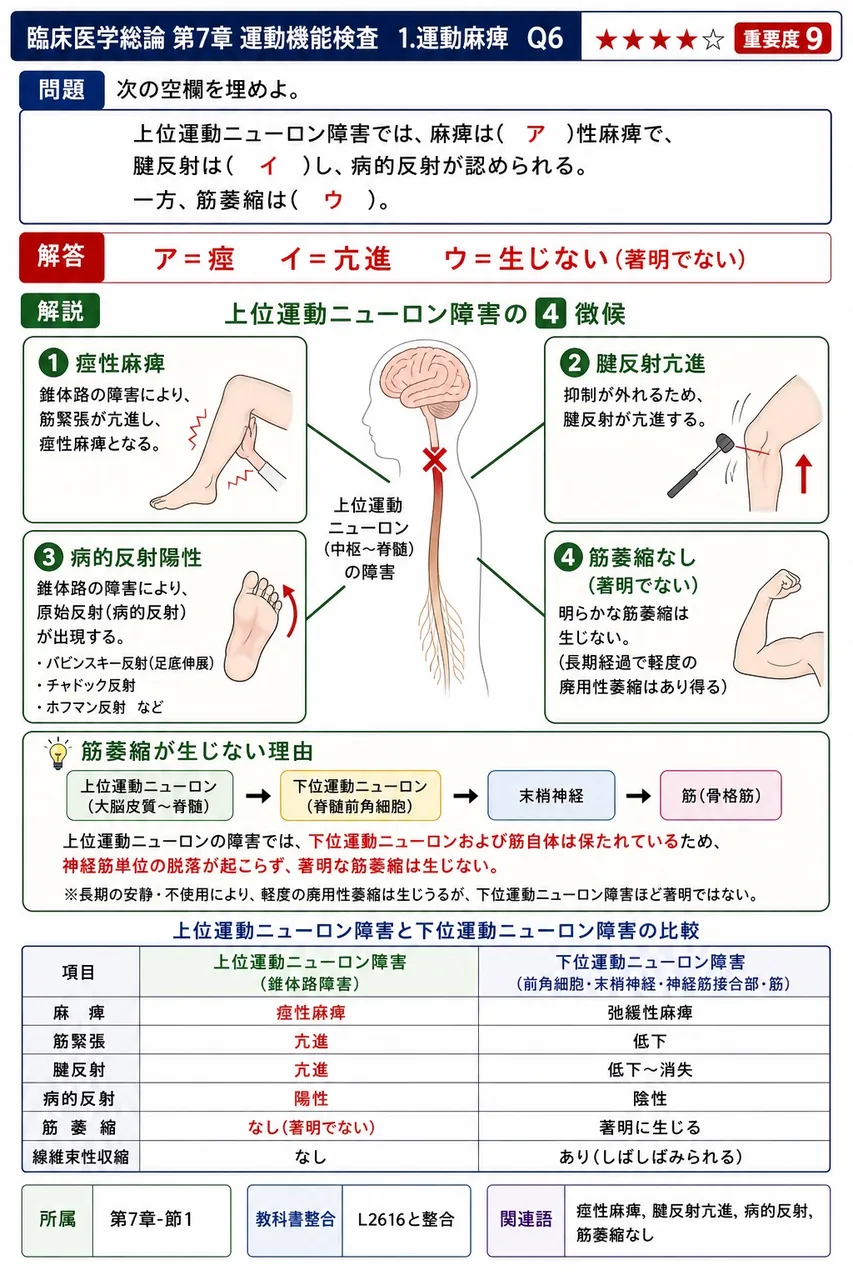 次の空欄を埋めよ。 「上位運動ニューロン障害では、麻痺は( ア )性麻痺で、腱反射は( イ )し、病的反射が認められる。一方、筋萎縮は( ウ )。」 解説図