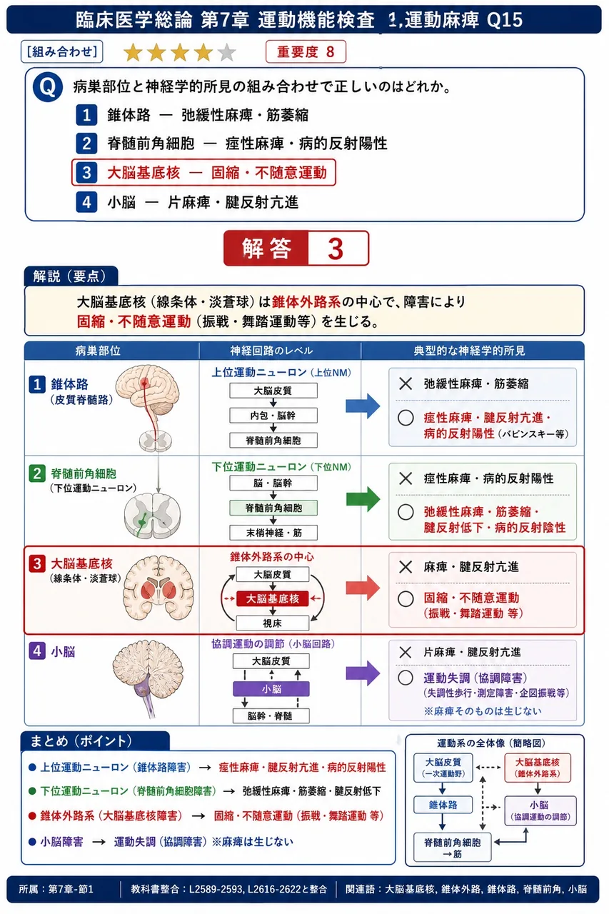 病巣部位と神経学的所見の組み合わせで正しいのはどれか。 解説図
