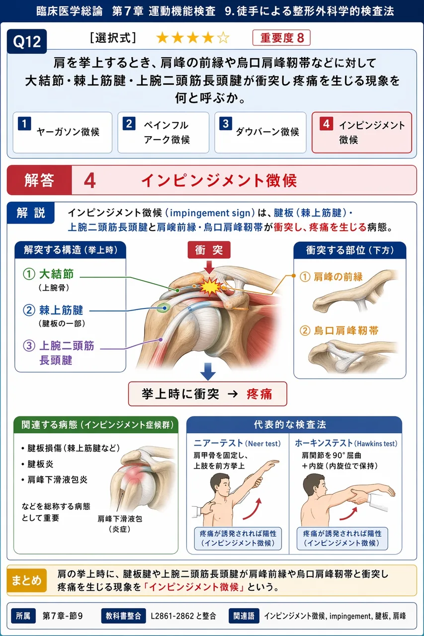 肩を挙上するとき、肩峰の前縁や烏口肩峰靱帯などに対して大結節・棘上筋腱・上腕二頭筋長頭腱が衝突し疼痛を生じる現象を何と呼ぶか。 解説図